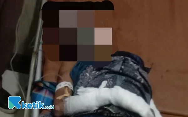 Thumbnail Berita - Mercon Rakitan Sendiri Meledak, 3 Anak Gandrungmangu Alami Luka Bakar Serius