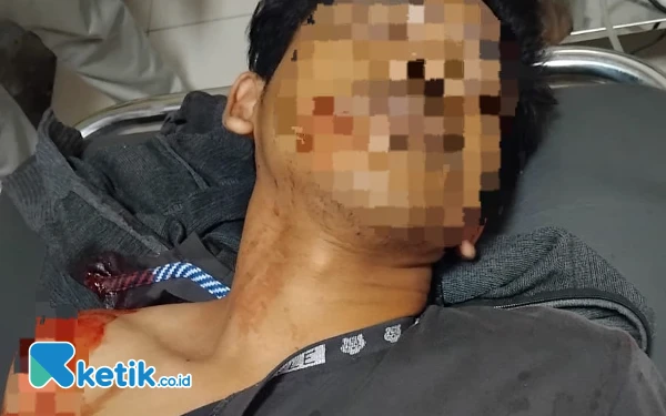 Thumbnail Seorang Nelayan di Ketapang Daya Diduga Jadi Korban Penganiayaan, Polisi Tidak Tahu