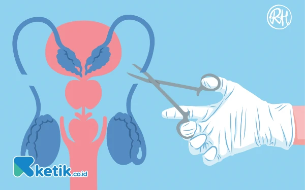 Thumbnail Masih Takut, Vasektomi Belum Banyak Dilirik Pria Kota Malang