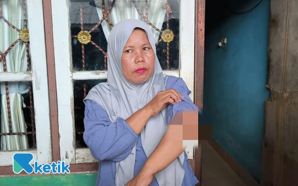 Thumbnail Begal Sadis Palembang, Tangan Ibu Ini Dicelurit Saat Pertahankan Motornya