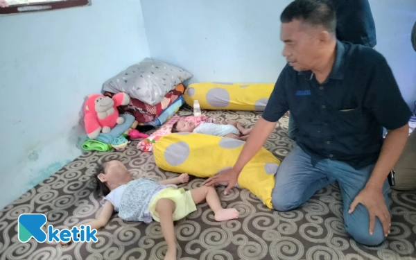 Thumbnail Berita - Jurnalis Kraksaan Santuni Elena Balita Penderita Hydro Syndrom Proteus