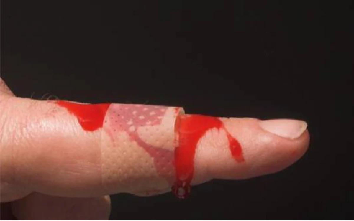 Thumbnail Berita - Akses Pengobatan Hemofilia Belum Merata, Terapi Pencegahan Masih Terbatas